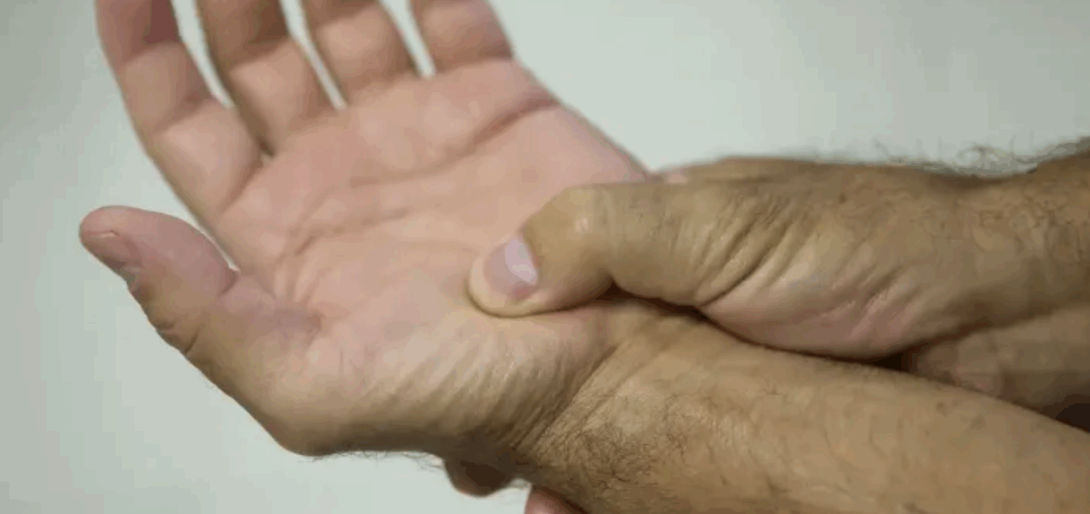 Lei passa a definir fibromialgia como deficiência em todo o país