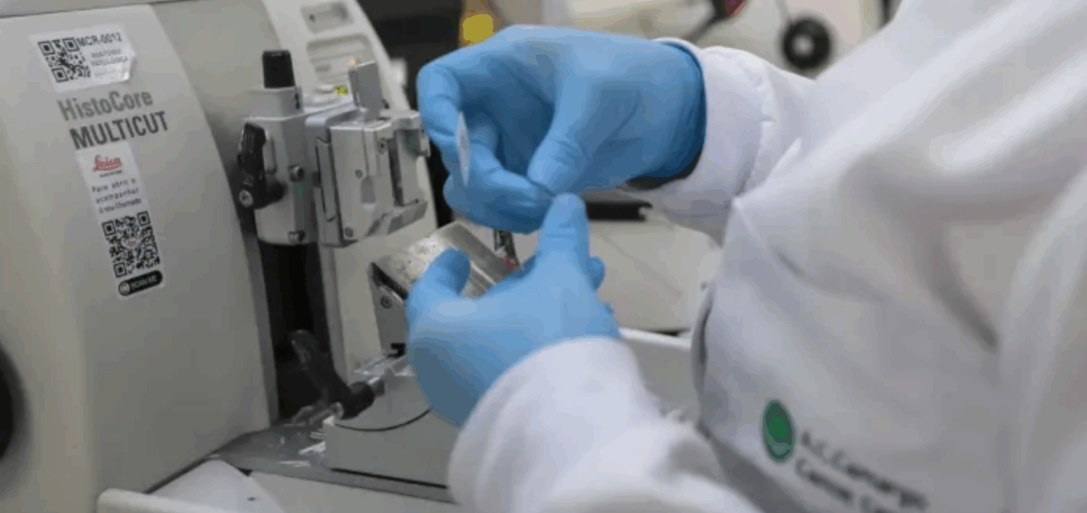 Cura de câncer de próstata pode chegar a até 98%