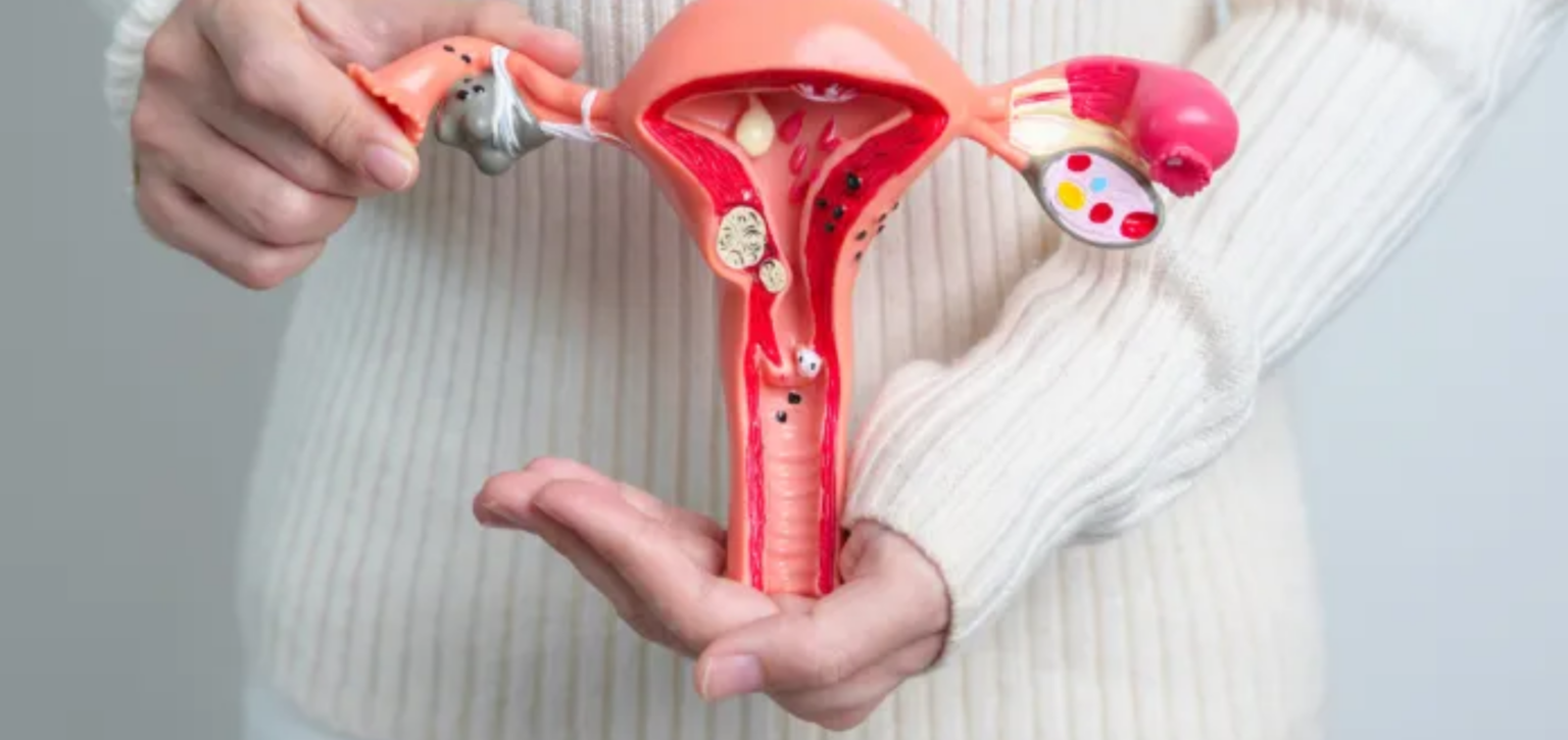 Endometriose severa: cirurgia robótica pode reduzir dor e riscos
