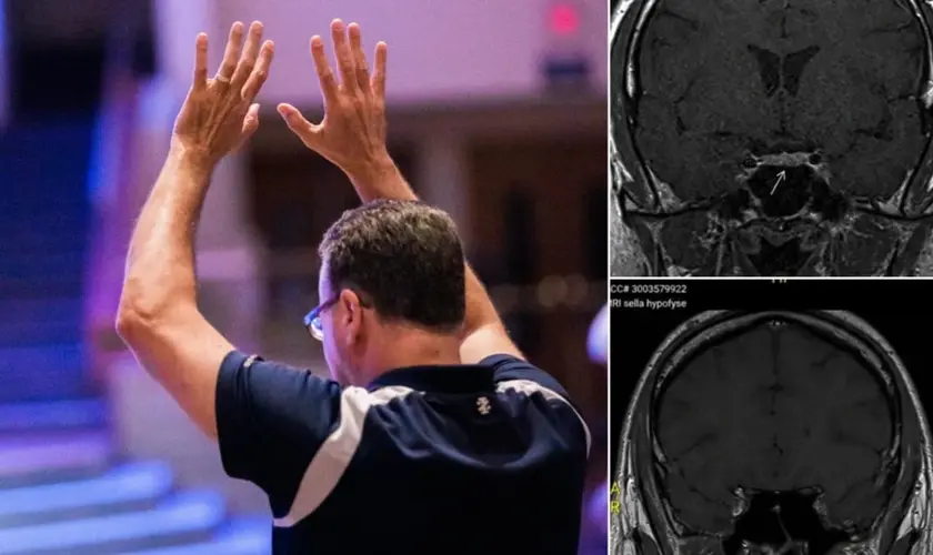 Homem testemunha desaparecimento de tumor cerebral após receber oração: “Os médicos não entendem”